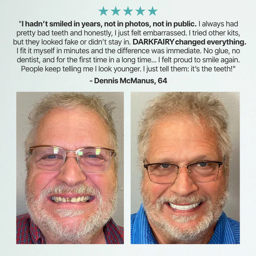 🔥DarkFairy™ Custom-Fit Dentures — Designed for Comfort and a Natural-Looking Smile