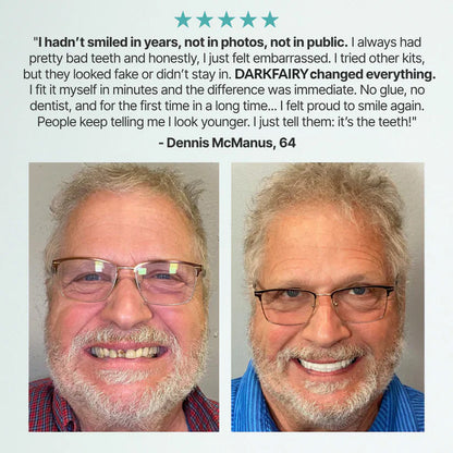 -DarkFairy™ Custom-Fit Dentures — Designed for Comfort and a Natural-Looking Smile