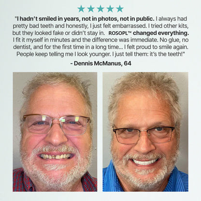 🦷HazyGalaxy™ Custom-Fit Functional Dentures — Made in the USA, Certified, Up to 70% OFF for a More Confident Smile!