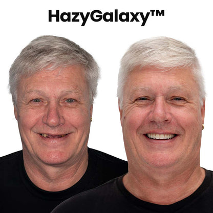 -🦷HazyGalaxy™ Custom-Fit Functional Dentures — Up to 70% OFF for a More Confident Smile!
