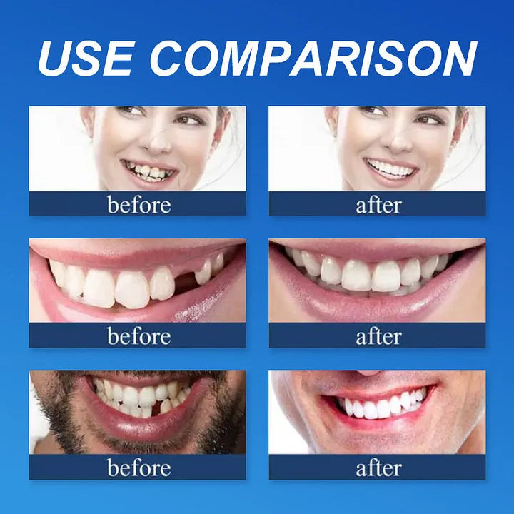 Ends Today: 70% OFF! ⏰HazyGalaxy™  Medical Full Denture with Strong Suctiond Custom-Fit Full Functional Dentures🦷