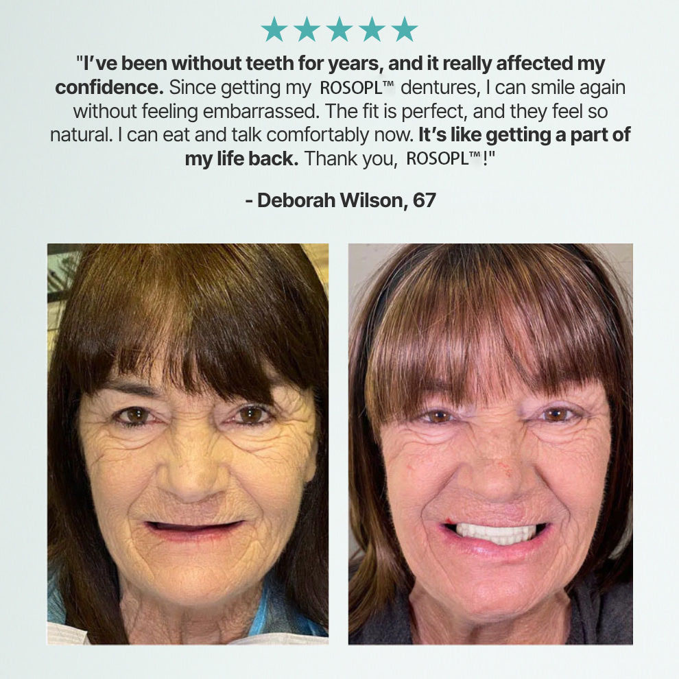 -🦷HazyGalaxy™ Custom-Fit Functional Dentures — Up to 70% OFF for a More Confident Smile!